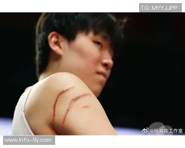 杨瀚森工作室的伤痕与拼搏见证了成长之路的艰辛与辉煌 杨瀚森工作室的伤痕与拼搏见证了成长之路的艰辛与辉煌